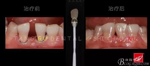 640.webp (4).jpg 640.webp (4).jpg