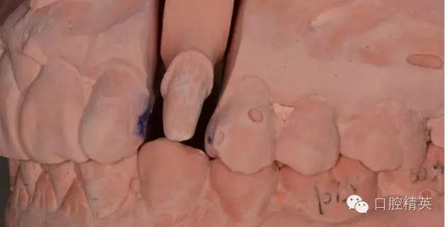 640.webp (5).jpg 640.webp (5).jpg