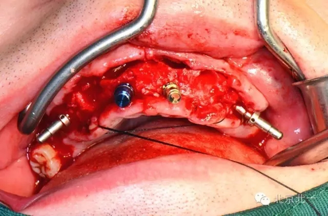 640.webp (2).jpg 640.webp (2).jpg