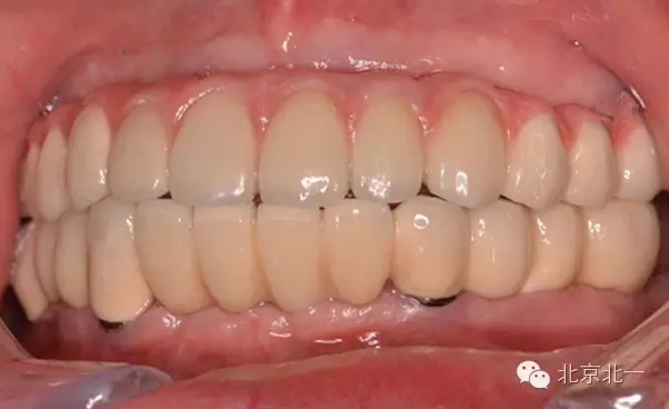 640.webp (4).jpg 640.webp (4).jpg