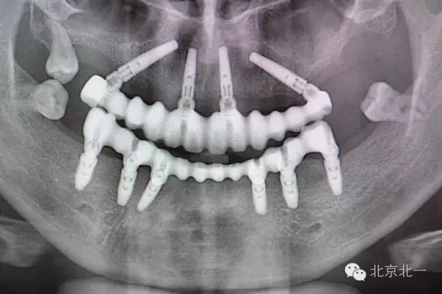 640.webp (6).jpg 640.webp (6).jpg