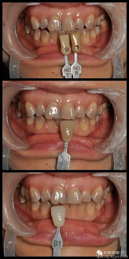 640.webp (6).jpg 640.webp (6).jpg