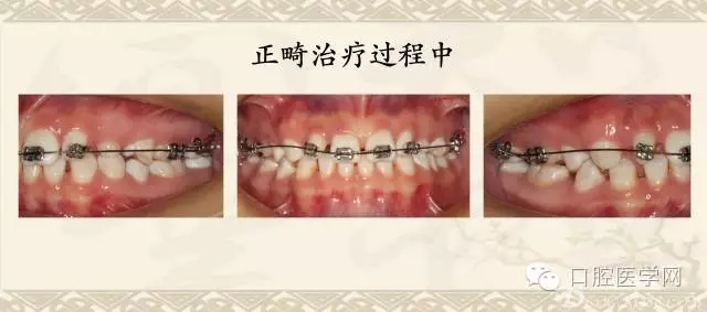 640.webp (3).jpg 640.webp (3).jpg