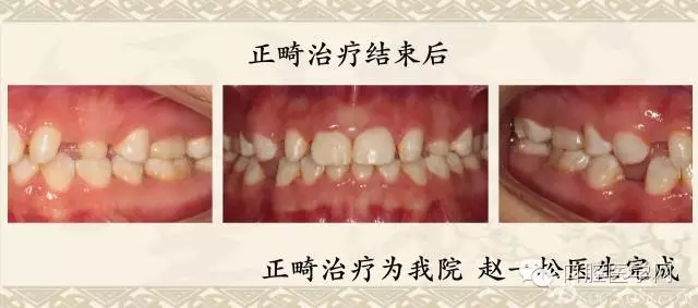 640.webp (4).jpg 640.webp (4).jpg