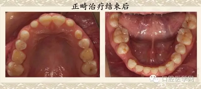 640.webp (5).jpg 640.webp (5).jpg