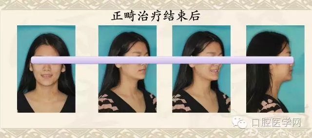 640.webp (6).jpg 640.webp (6).jpg