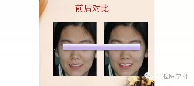 640.webp (12).jpg 640.webp (12).jpg