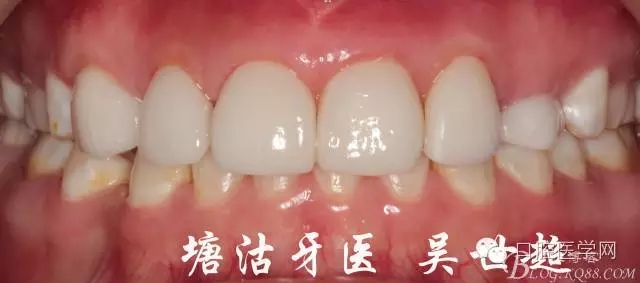 640.webp (16).jpg 640.webp (16).jpg