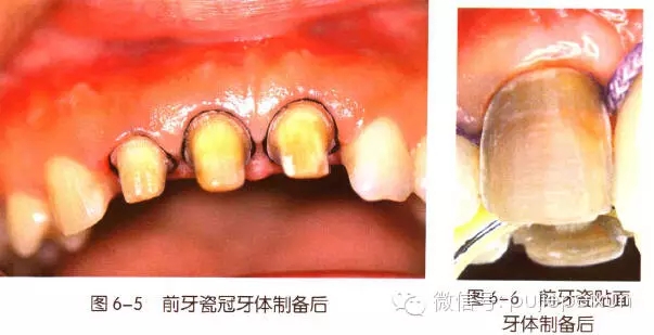 640.webp (2).jpg 640.webp (2).jpg