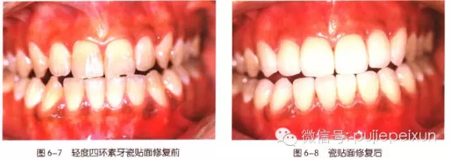 640.webp (3).jpg 640.webp (3).jpg