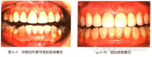 640.webp (4).jpg 640.webp (4).jpg