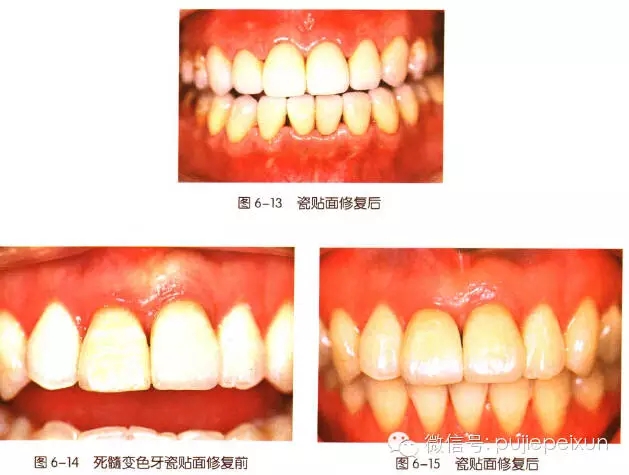 640.webp (6).jpg 640.webp (6).jpg