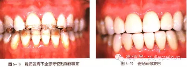 640.webp (9).jpg 640.webp (9).jpg