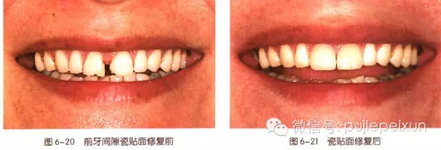 640.webp (10).jpg 640.webp (10).jpg