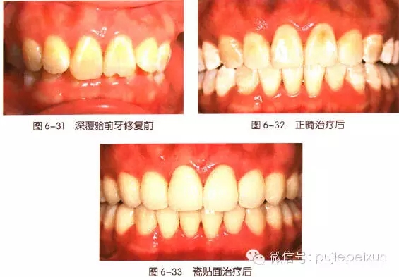 640.webp (15).jpg 640.webp (15).jpg