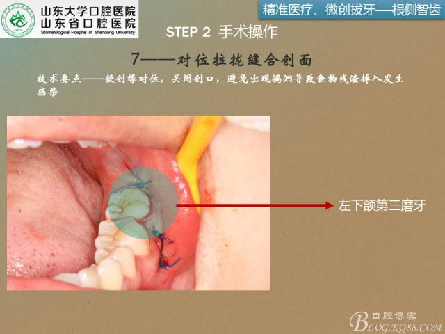 640 (13).jpg 640 (13).jpg