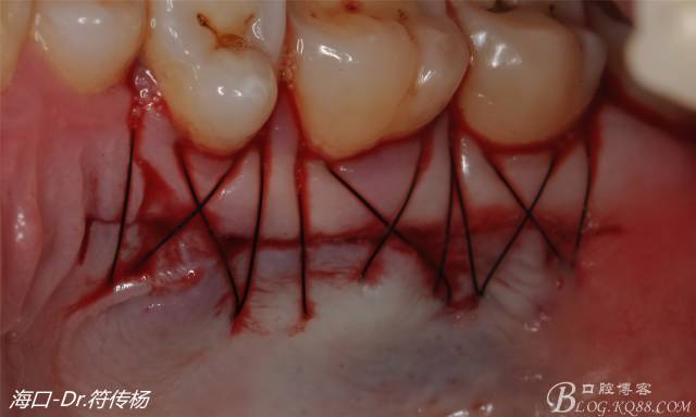 640 (14).jpg 640 (14).jpg