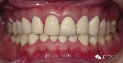 640.webp.jpg 640.webp.jpg