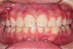 20131035372056565.jpg 20131035372056565.jpg