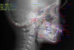 20131037579498727.jpg 20131037579498727.jpg