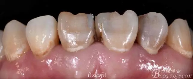 640.webp.jpg 640.webp.jpg