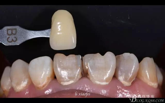 640.webp (1).jpg 640.webp (1).jpg