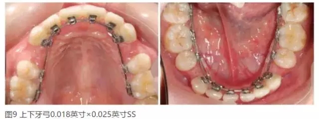 640.webp (1).jpg 640.webp (1).jpg