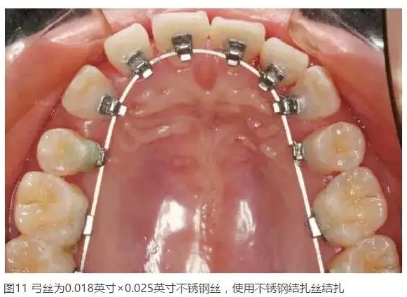 640.webp (3).jpg 640.webp (3).jpg