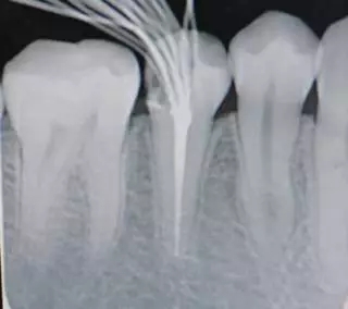 640.webp.jpg 640.webp.jpg