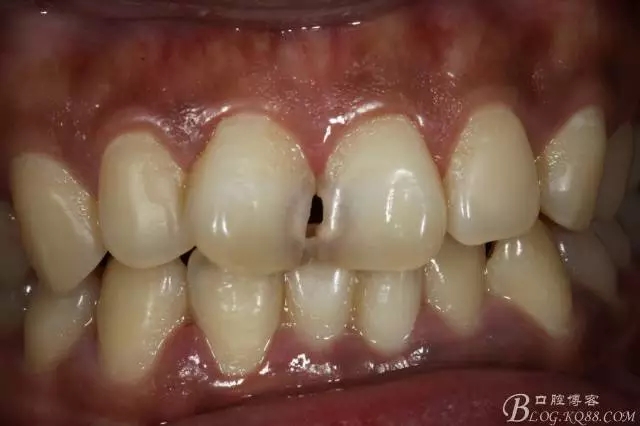 640.webp.jpg 640.webp.jpg