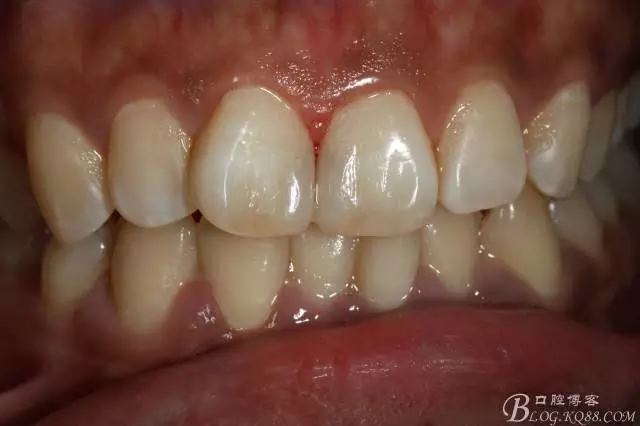 640.webp (2).jpg 640.webp (2).jpg