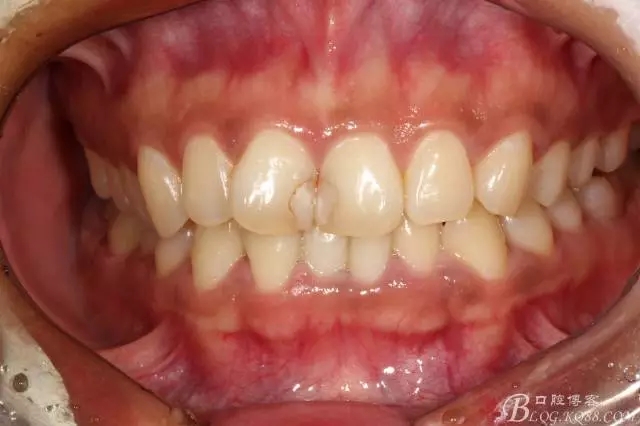 640.webp (3).jpg 640.webp (3).jpg