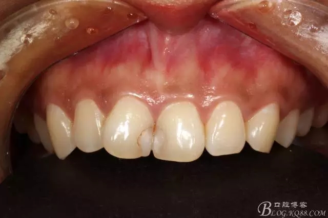 640.webp (4).jpg 640.webp (4).jpg