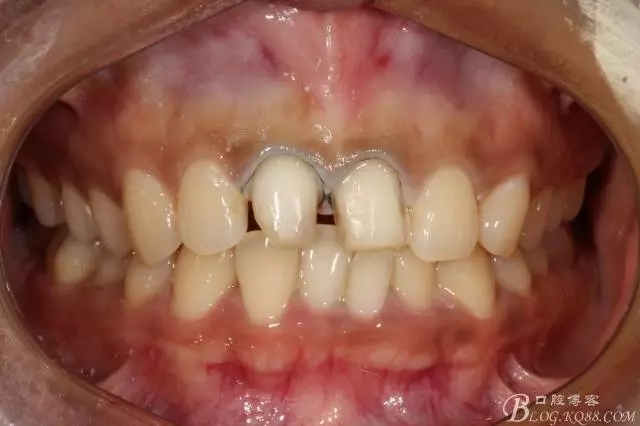 640.webp (5).jpg 640.webp (5).jpg