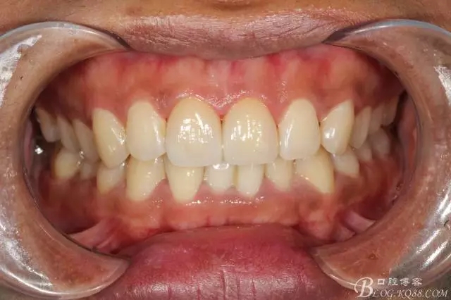 640.webp (9).jpg 640.webp (9).jpg