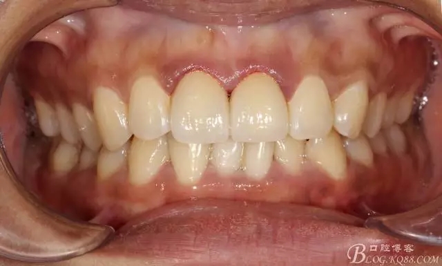 640.webp (11).jpg 640.webp (11).jpg