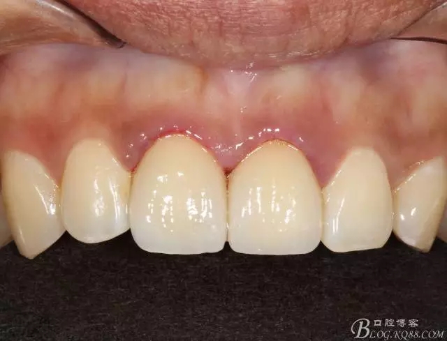 640.webp (12).jpg 640.webp (12).jpg