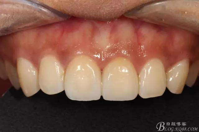 640.webp (14).jpg 640.webp (14).jpg