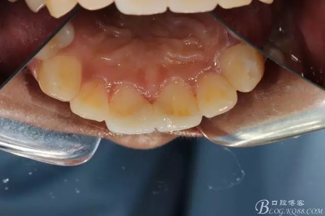 640.webp (15).jpg 640.webp (15).jpg