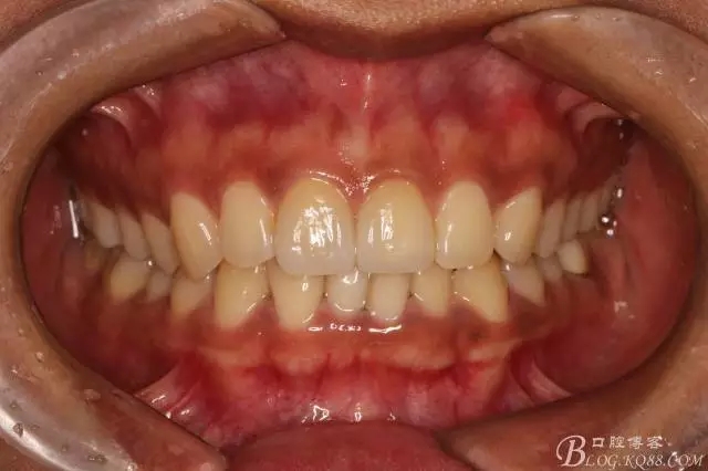 640.webp (17).jpg 640.webp (17).jpg