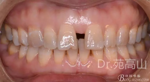 640.webp.jpg 640.webp.jpg