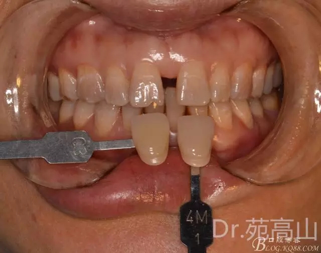 640.webp (2).jpg 640.webp (2).jpg