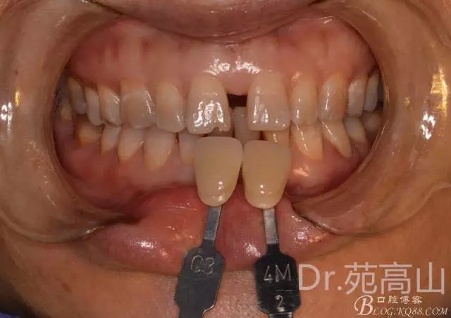 640.webp (3).jpg 640.webp (3).jpg