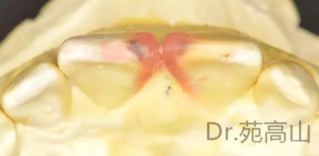 640.webp (5).jpg 640.webp (5).jpg