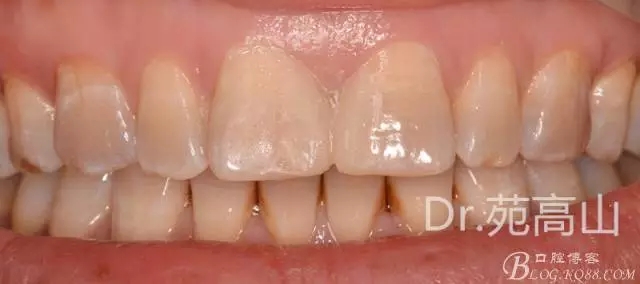 640.webp (7).jpg 640.webp (7).jpg