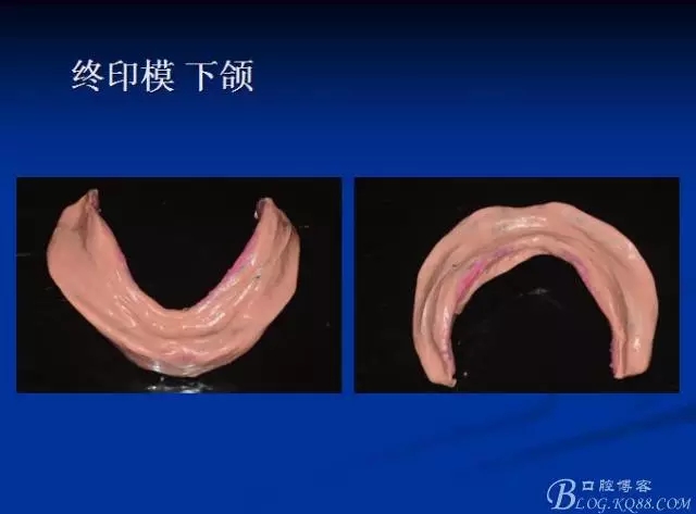 640.webp (15).jpg 640.webp (15).jpg