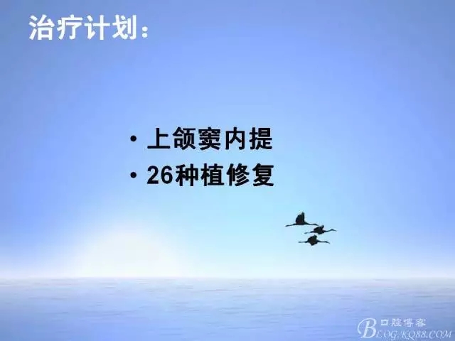 640.webp (4).jpg 640.webp (4).jpg