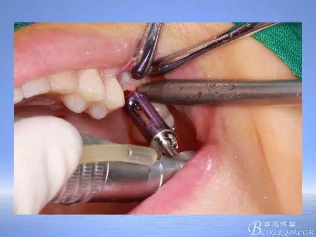 640.webp (15).jpg 640.webp (15).jpg