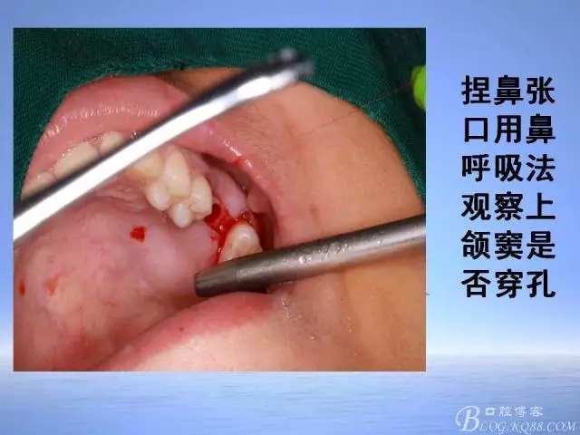 640.webp (21).jpg 640.webp (21).jpg