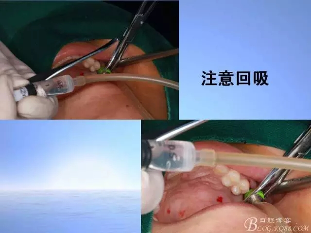 640.webp (23).jpg 640.webp (23).jpg